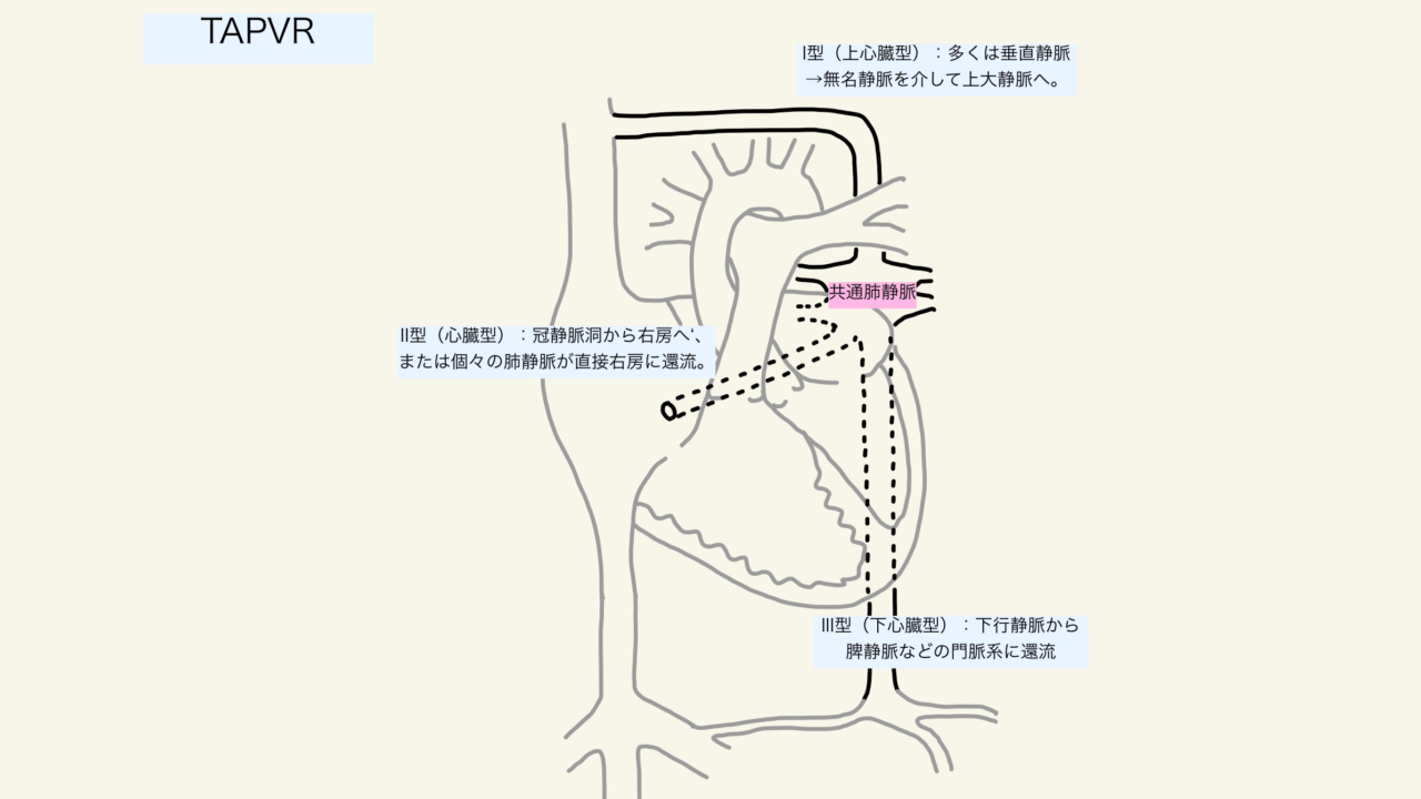 部分 完全肺静脈還流異常症の周術期管理 シェアする挑戦者 Md Mph